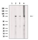 Phospho-TAK1 (Ser389) Antibody in Western Blot (WB)