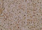 Phospho-TAK1 (Ser192) Antibody in Immunohistochemistry (Paraffin) (IHC (P))