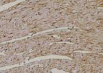 Phospho-TAK1 (Ser192) Antibody in Immunohistochemistry (Paraffin) (IHC (P))