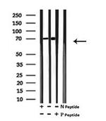 Phospho-TAK1 (Ser192) Antibody in Western Blot (WB)