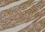 Phospho-RIP2 (Tyr381) Antibody in Immunohistochemistry (Paraffin) (IHC (P))