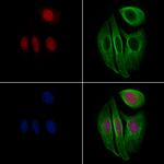 Phospho-FOXO3A (Ser284) Antibody in Immunocytochemistry (ICC/IF)