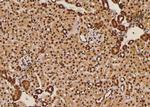 Phospho-LAT (Tyr45) Antibody in Immunohistochemistry (Paraffin) (IHC (P))