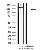 Phospho-KIF1B (Ser1057) Antibody in Western Blot (WB)