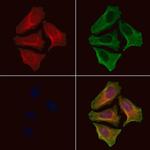 Phospho-AS160 (Ser341) Antibody in Immunocytochemistry (ICC/IF)