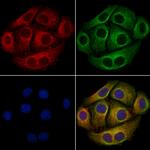 Phospho-delta Catenin (Tyr248) Antibody in Immunocytochemistry (ICC/IF)