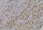 Phospho-delta Catenin (Tyr248) Antibody in Immunohistochemistry (Paraffin) (IHC (P))