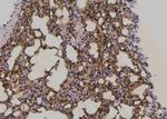 Phospho-delta Catenin (Tyr248) Antibody in Immunohistochemistry (Paraffin) (IHC (P))