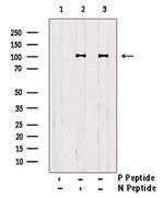 Phospho-delta Catenin (Tyr248) Antibody in Western Blot (WB)