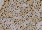 Phospho-delta Catenin (Tyr280) Antibody in Immunohistochemistry (Paraffin) (IHC (P))