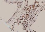 Phospho-delta Catenin (Tyr96) Antibody in Immunohistochemistry (Paraffin) (IHC (P))