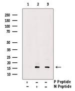 Phospho-VAMP4 (Ser88) Antibody in Western Blot (WB)