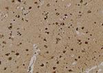 Phospho-ULK1 (Ser131) Antibody in Immunohistochemistry (Paraffin) (IHC (P))