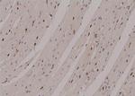 Phospho-ULK1 (Ser131) Antibody in Immunohistochemistry (Paraffin) (IHC (P))