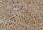 Phospho-ULK1 (Ser131) Antibody in Immunohistochemistry (Paraffin) (IHC (P))