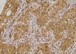 Phospho-ULK1 (Ser556) Antibody in Immunohistochemistry (Paraffin) (IHC (P))