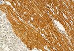 Phospho-IRE1 alpha (Ser724) Antibody in Immunohistochemistry (Paraffin) (IHC (P))