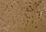 Phospho-IRE1 alpha (Ser724) Antibody in Immunohistochemistry (Paraffin) (IHC (P))