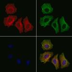 Phospho-IRE1 alpha (Tyr628) Antibody in Immunocytochemistry (ICC/IF)
