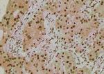 Phospho-IRE1 alpha (Tyr628) Antibody in Immunohistochemistry (Paraffin) (IHC (P))