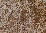 Phospho-IRE1 alpha (Tyr628) Antibody in Immunohistochemistry (Paraffin) (IHC (P))