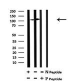 Phospho-IRE1 alpha (Tyr628) Antibody in Western Blot (WB)