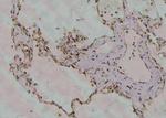 Phospho-DR6 (Thr460) Antibody in Immunohistochemistry (Paraffin) (IHC (P))