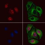 Phospho-MSK2 (Thr687) Antibody in Immunocytochemistry (ICC/IF)