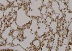 Phospho-RAD17 (Ser359) Antibody in Immunohistochemistry (Paraffin) (IHC (P))