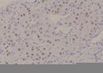 Phospho-NFAT5 (Ser145) Antibody in Immunohistochemistry (Paraffin) (IHC (P))