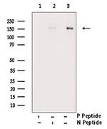 Phospho-NFAT5 (Ser145) Antibody in Western Blot (WB)