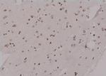 Phospho-KIF20A (Tyr869) Antibody in Immunohistochemistry (Paraffin) (IHC (P))