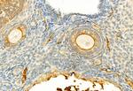 Phospho-LATS1 (Thr1079) Antibody in Immunohistochemistry (Paraffin) (IHC (P))