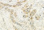 Phospho-LATS1 (Thr1079) Antibody in Immunohistochemistry (Paraffin) (IHC (P))