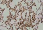 Phospho-LATS1 (Tyr283) Antibody in Immunohistochemistry (Paraffin) (IHC (P))