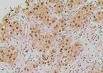 Phospho-TK1 (Tyr181) Antibody in Immunohistochemistry (Paraffin) (IHC (P))