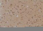 Phospho-TrkA (Tyr791) Antibody in Immunohistochemistry (Paraffin) (IHC (P))