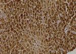 Phospho-TrkA (Tyr791) Antibody in Immunohistochemistry (Paraffin) (IHC (P))