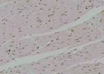 Phospho-TrkA (Tyr791) Antibody in Immunohistochemistry (Paraffin) (IHC (P))