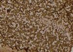 Phospho-EIF2S1 (Tyr150) Antibody in Immunohistochemistry (Paraffin) (IHC (P))