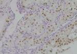 Phospho-PKC beta-1 (Thr642, Thr644) Antibody in Immunohistochemistry (Paraffin) (IHC (P))