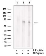 Phospho-LCK (Tyr394) Antibody in Western Blot (WB)