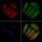 Phospho-EPRS (Tyr377) Antibody in Immunocytochemistry (ICC/IF)