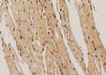 Phospho-IGF1R alpha (Thr1163) Antibody in Immunohistochemistry (Paraffin) (IHC (P))