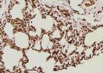 Phospho-IGF1R alpha (Thr1163) Antibody in Immunohistochemistry (Paraffin) (IHC (P))