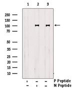 Phospho-IGF1R alpha (Thr1163) Antibody in Western Blot (WB)