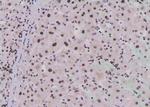 Phospho-EEF2 (Tyr443) Antibody in Immunohistochemistry (Paraffin) (IHC (P))