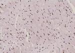 Phospho-EEF2 (Tyr443) Antibody in Immunohistochemistry (Paraffin) (IHC (P))