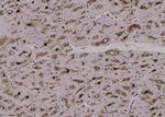 Phospho-BRAF (Ser729) Antibody in Immunohistochemistry (Paraffin) (IHC (P))