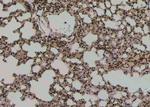 Phospho-BRAF (Ser729) Antibody in Immunohistochemistry (Paraffin) (IHC (P))